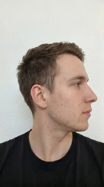 Side profile